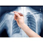 Marqueur Spécial Radiologie 8010 Blanc Pointe Fine 0 8 mm EDDING